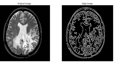 article IJEAP: Edge detection method of brain MR images