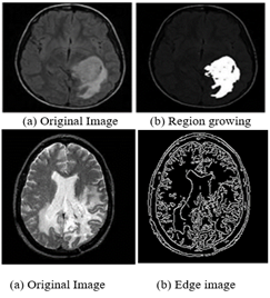 article IJEAP : Brain Tumour Detection and Classffication Using CNN 